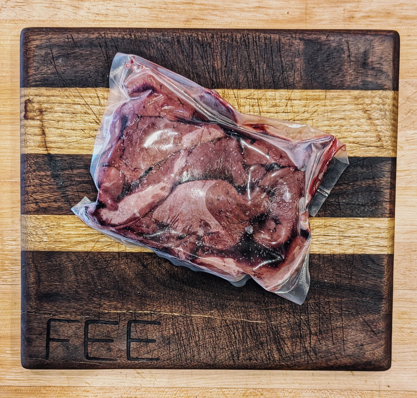 Liver
